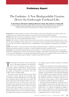 Endotine Forehead Article 1
