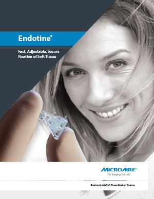 Endotine Forehead Brochure